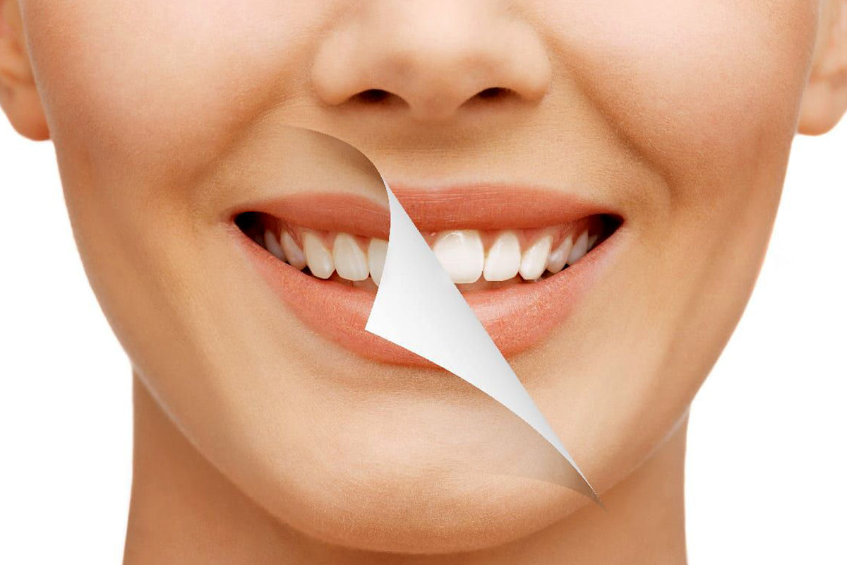 آیا جرمگیری به مینای دندان آسیب میزند؟